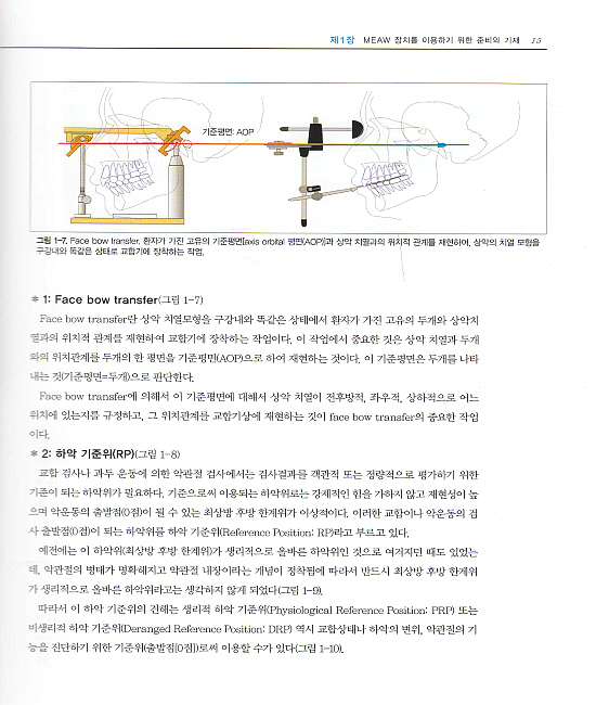 MEAW를 이용한 교정치료의 기본테크닉