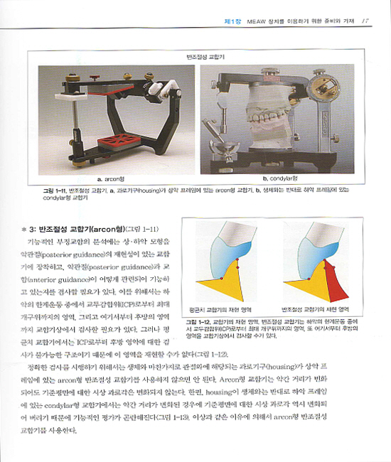 MEAW를 이용한 교정치료의 기본테크닉