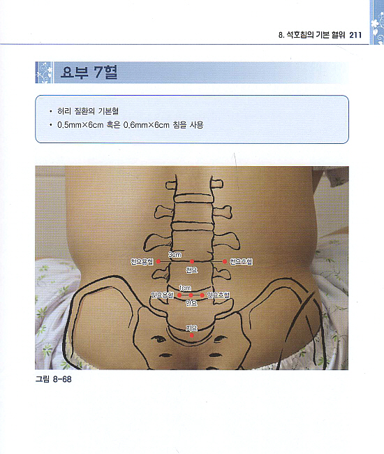 석호침법