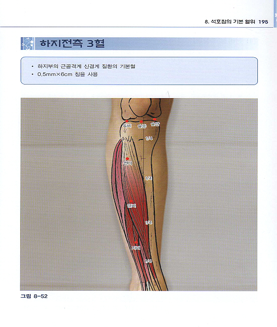 석호침법