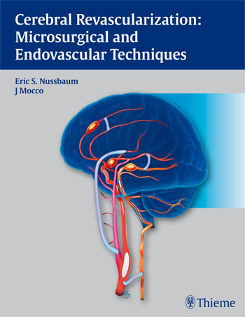 Cerebral Revascularization : Microsurgical and Endovascular Techniques