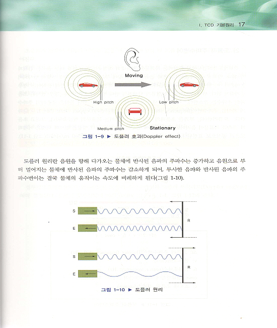 경두개도플러 검사(Transcranial Doppler)