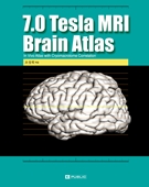 7.0 Tesla MRI Brain Atlas 번역서