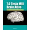 7.0 Tesla MRI Brain Atlas 번역서