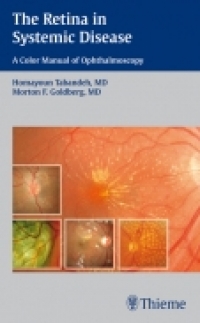 The Retina in Systemic Disease : A Color Manual of Ophthalmoscopy