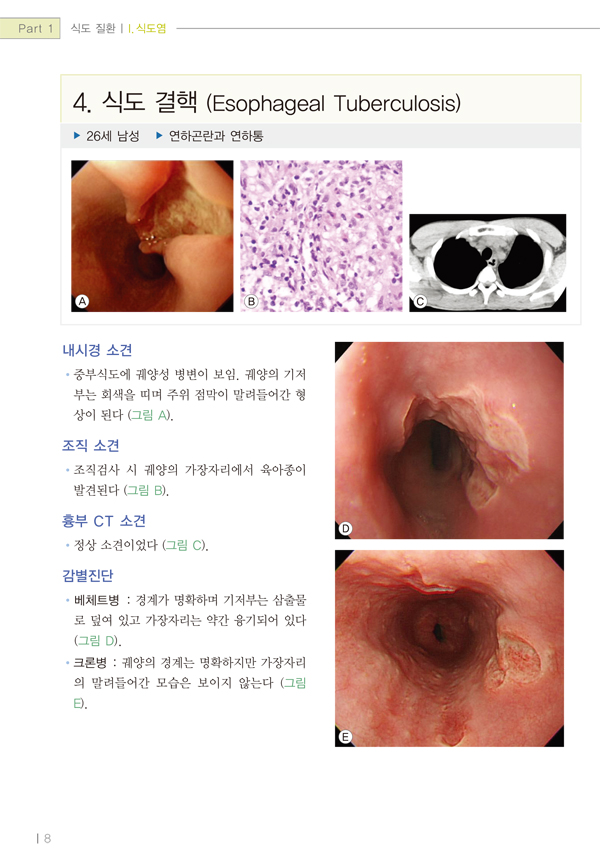 임상 소화기 내시경 - 실전공략