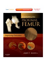 Fractures of the Proximal Femur: Improving Outcomes
