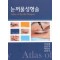 눈꺼풀 성형술