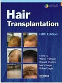 Hair Transplantation, 5/e(with Procedural DVD)