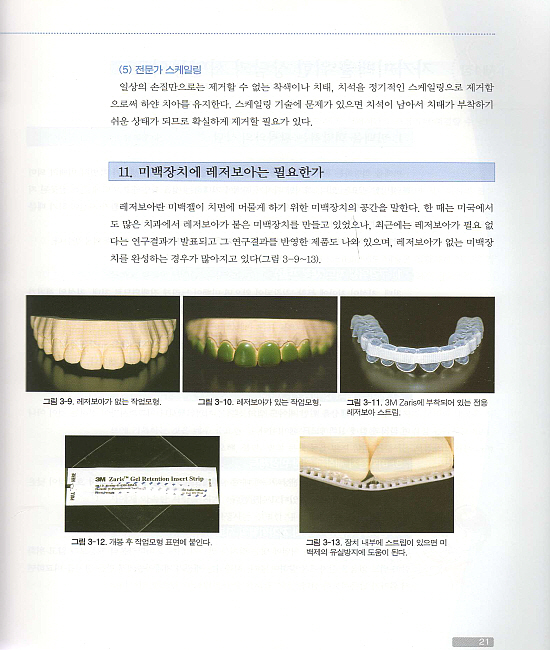 치과위생사를 위한 치아미백 (제2판)