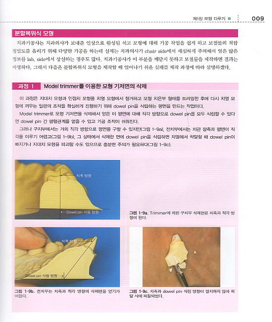 졸업 후 5년 이내에 숙달시켜야 할 Crown · Inlay · Core 기공 작업의 요령과 핵심