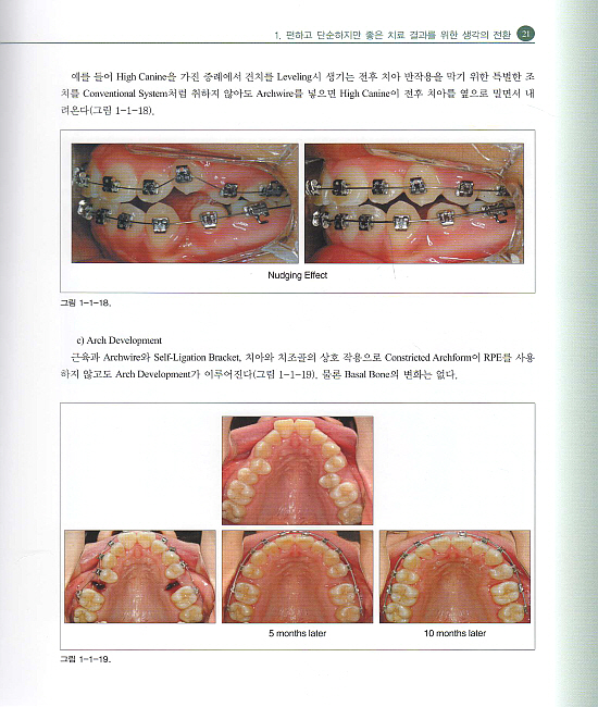 Efficiency and Excellence in Self-Ligation Orthodontics