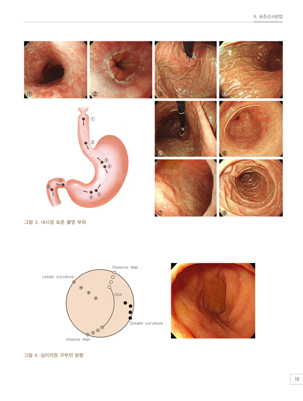 소화기내시경아틀라스-상부위장관 : 전공의와 개원의를 위한