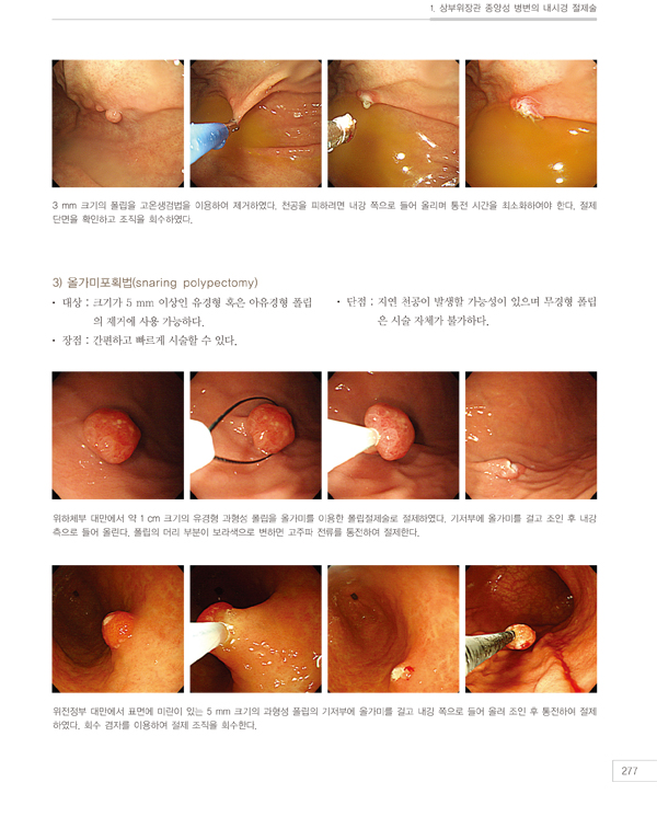 소화기내시경아틀라스-상부위장관 : 전공의와 개원의를 위한