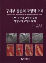 구치부 결손의 교정적 수복 -Orthodontic Replacement of Missing Posterior Teeth-