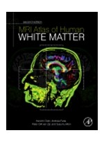MRI Atlas of Human White Matter,2/e