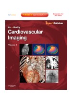 Cardiovascular Imaging (2Vols)