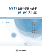 NiTi 전동파일을 이용한 근관치료 제2판