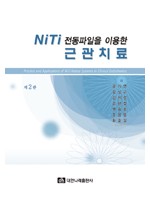 NiTi 전동파일을 이용한 근관치료 제2판