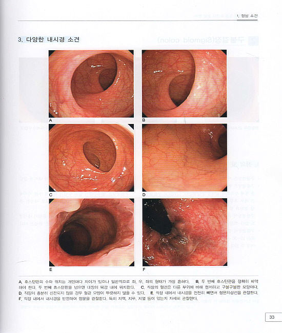 소화기내시경아틀라스 2vol. - 상부위장관 / 하부위장관