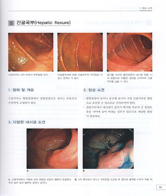 소화기내시경아틀라스 2vol. - 상부위장관 / 하부위장관