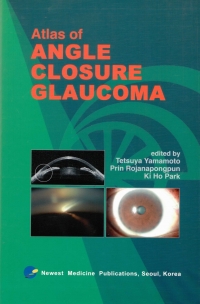 Atlas of ANGLE CLOSURE GLAUCOMA