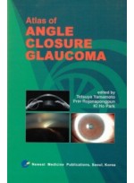 Atlas of ANGLE CLOSURE GLAUCOMA