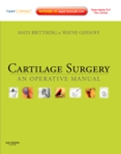 Cartilage Surgery: An Operative Manual