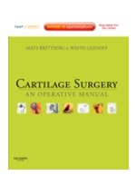 Cartilage Surgery: An Operative Manual