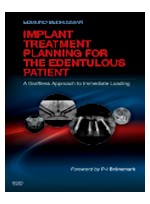 Implant Treatment Planning for the Edentulous Patient