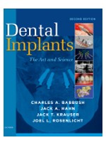 Dental Implants, 2nd Edition