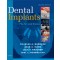 Dental Implants, 2nd Edition