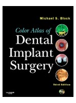 Color Atlas of Dental Implant Surgery, 3rd Edition