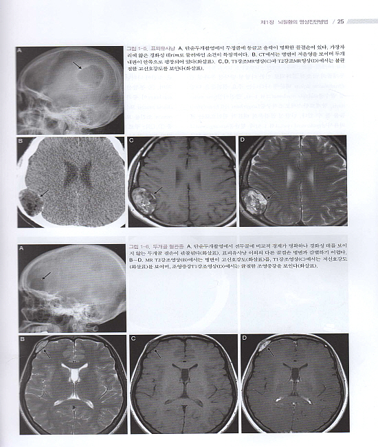 신경영상의학(신경방사선과학 개정판)