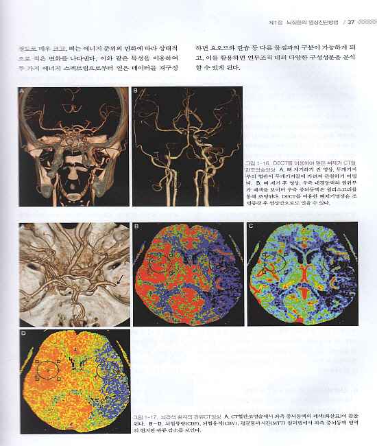 신경영상의학(신경방사선과학 개정판)