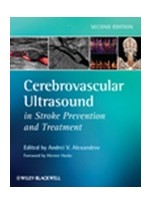 Cerebrovascular Ultrasound in Stroke Prevention & Treatment,2/e