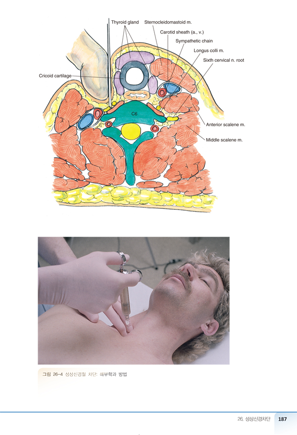 신경블록 술기 아틀라스 - 임상의를 위한