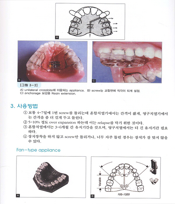 성장중인 혼합치열기 아동의 정형적 · 교정적 치료