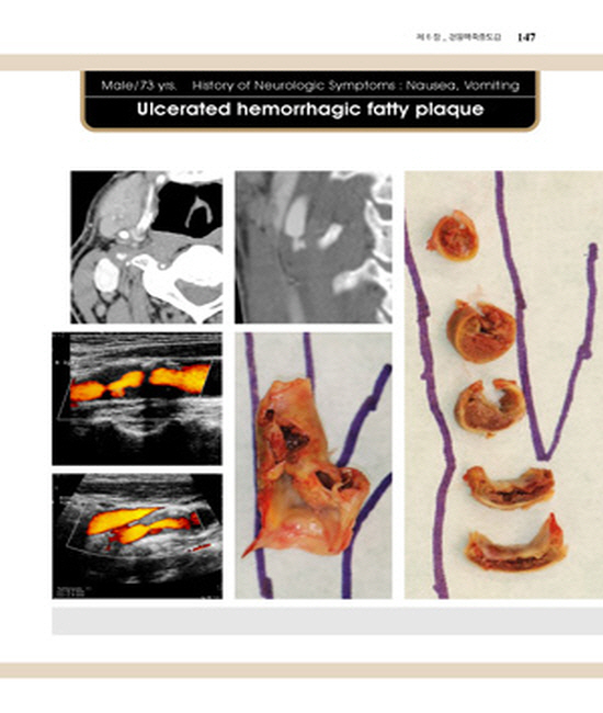 경동맥질환:진단과치료(DVD포함)