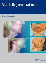 Neck Rejuvenation