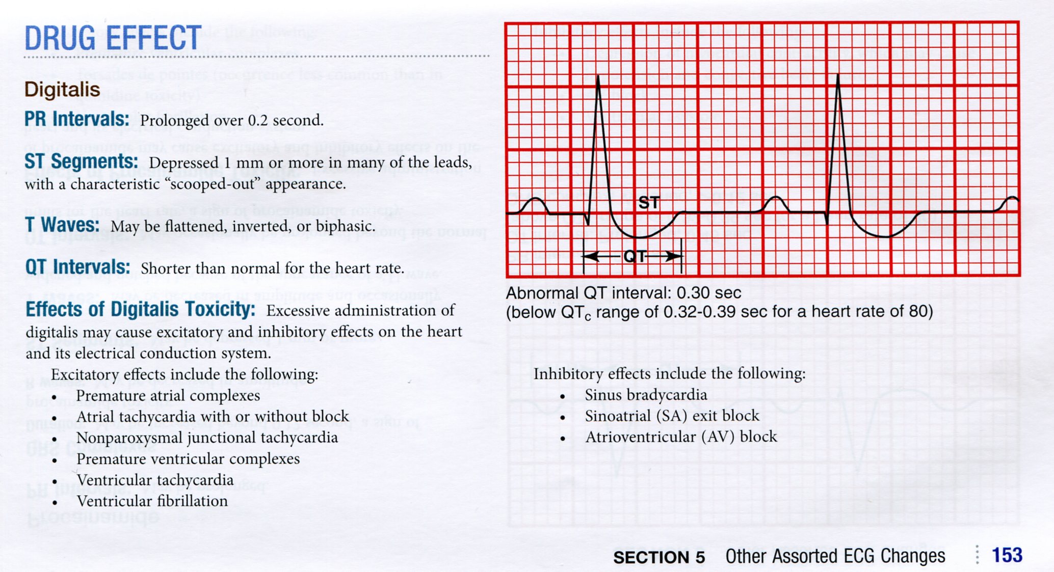 Basic Dysrhythmias and Coronary Syndromes - Pocket Guide for Huszar's