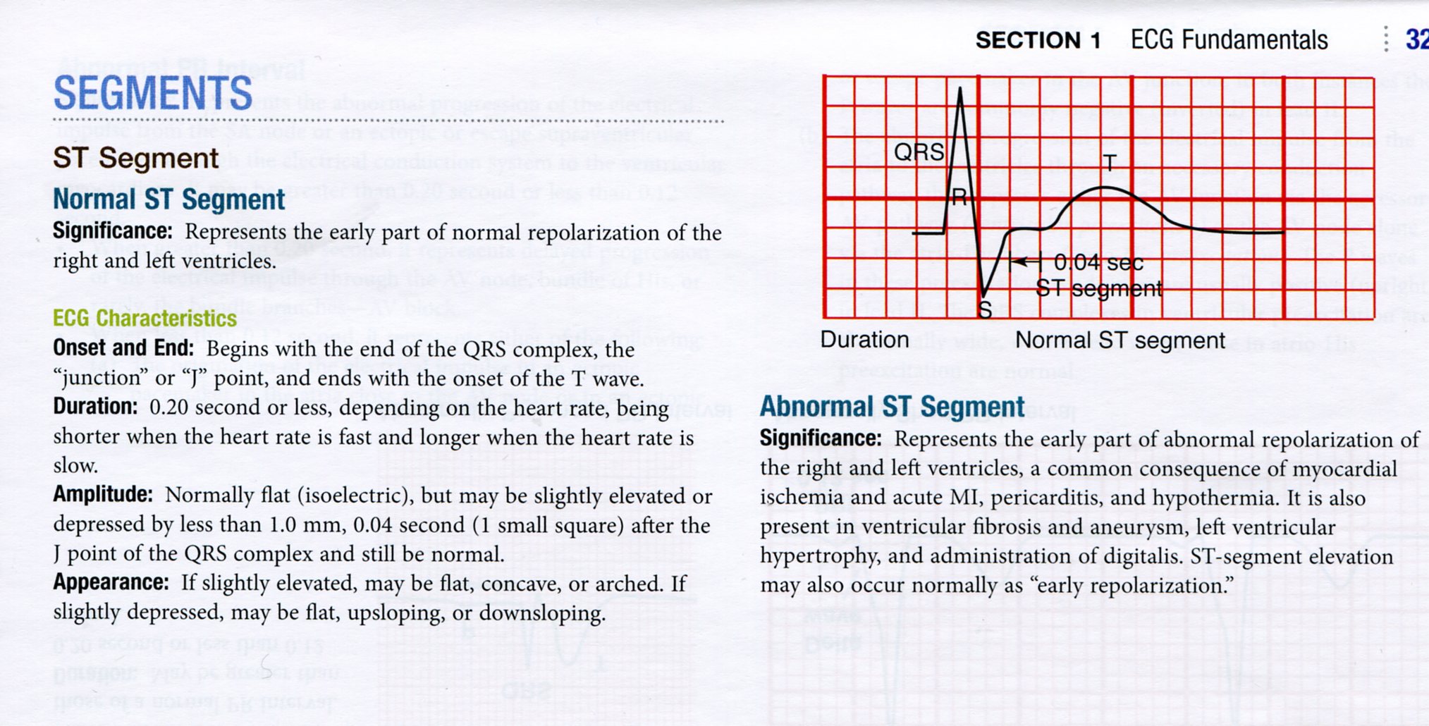 Basic Dysrhythmias and Coronary Syndromes - Pocket Guide for Huszar's