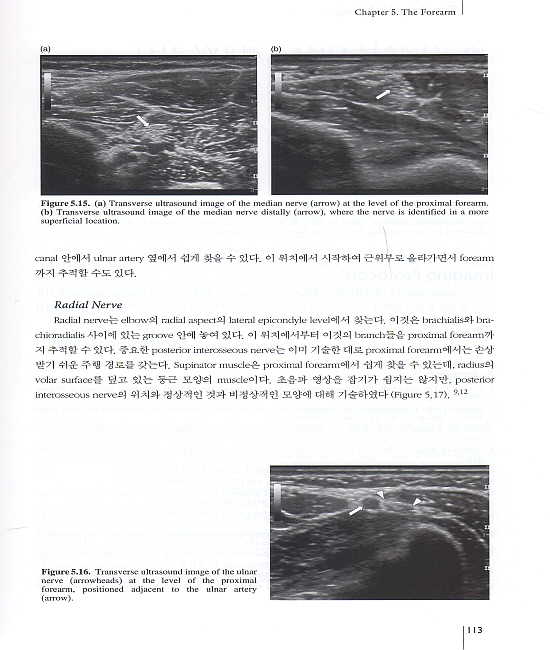 핵심 근골격계 초음파(정상 해부학 및 초음파 검사법), DVD포함