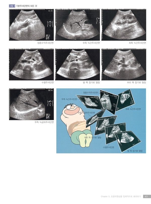 복부초음파 - 더 쉽고 더 재미있게 배우는