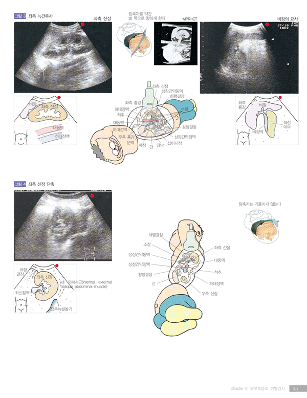 복부초음파 - 더 쉽고 더 재미있게 배우는