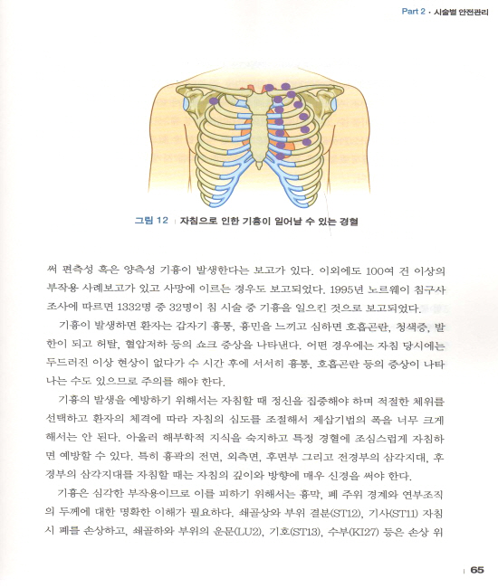 침구시술 안전가이드