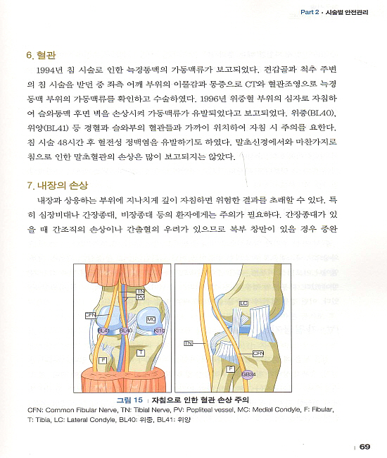 침구시술 안전가이드