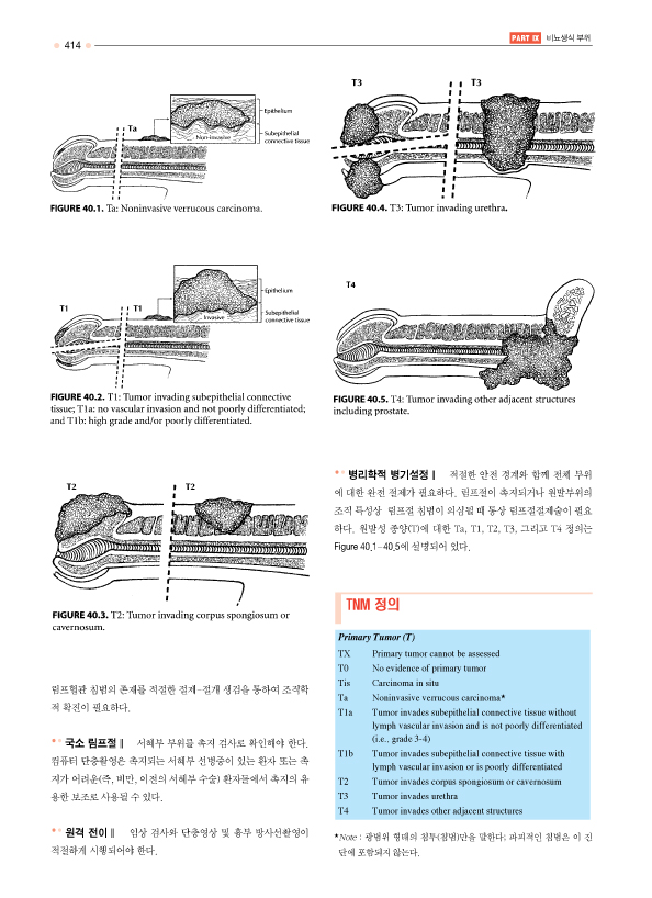 암 병기설정 메뉴얼 CD포함 AJCC Cancer Staging Manual  (7판번역본)