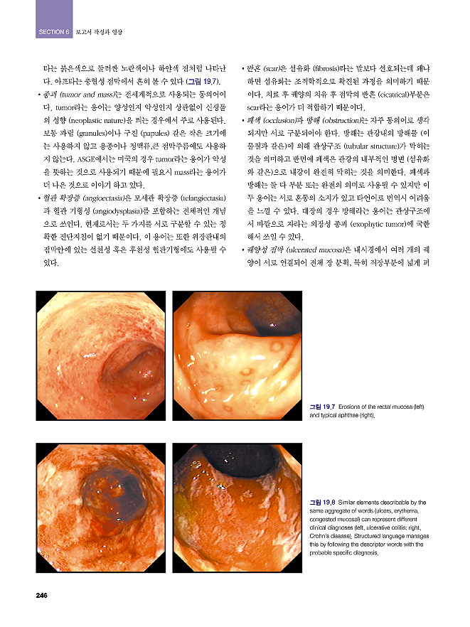 대장내시경 Colonoscopy : 진단 & 치료술기+동영상