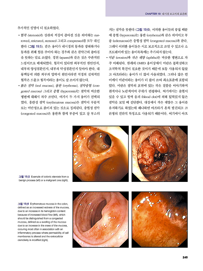 대장내시경 Colonoscopy : 진단 & 치료술기+동영상